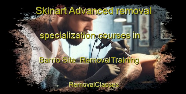 Skinart Advanced removal specialization courses in Barrio Site | RemovalTraining | RemovalClasses | SkinartTraining-Philippines