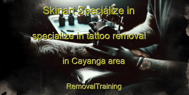 Skinart Specialize in specialize in tattoo removal in Cayanga area | RemovalTraining | RemovalClasses | SkinartTraining-Philippines